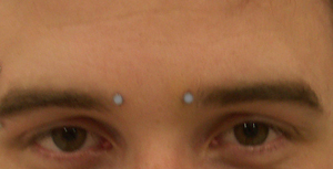 microdermal piercing